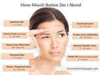 Botox Treatment for upper face wrinkles